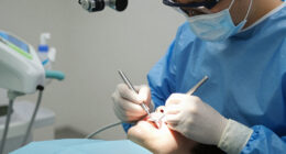 Kelly Ripa Dental Procedure